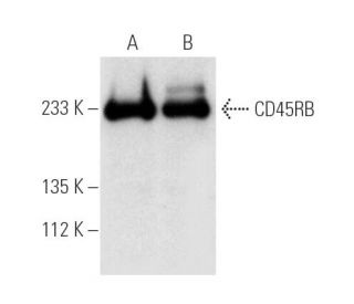 CD45RB Antibody (16A) - Western Blotting - Image 4857 