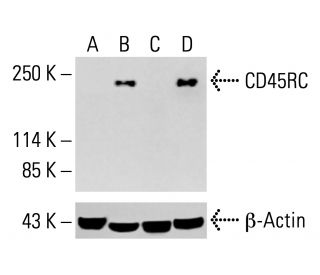 CD45RC Antibody (3H1437) - Western Blotting - Image 413288 