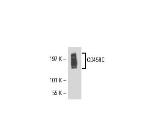 CD45RC Antibody (6A295) - Western Blotting - Image 17823 