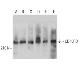 CD45RO Antibody (2Q1392) - Western Blotting - Image 360554 