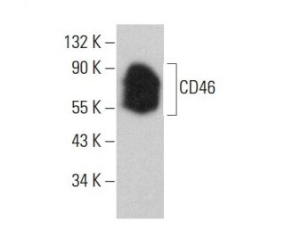 CD46 Antibody (E4.3) - Western Blotting - Image 377654 