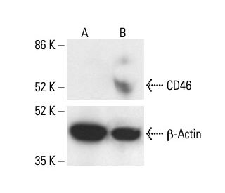 CD46 Antibody (M177) - Western Blotting - Image 411886