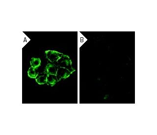 CD46 siRNA (h): sc-35004. Immunofluorescence staining of methanol-fixed, control HeLa (A) and CD46 siRNA silenced HeLa (B) 