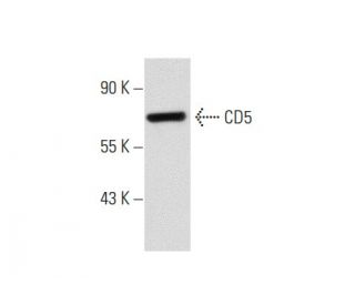 CD5 Antibody (L17F12) - Western Blotting - Image 62194 