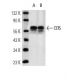 CD5 Antibody (Y2/178) - Western Blotting - Image 12763