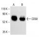 CD58 Antibody (TS2/9) - Western Blotting - Image 413385
