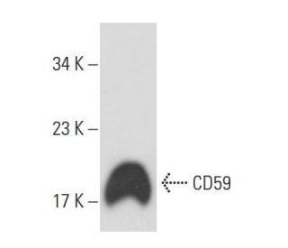 CD59 Antibody (1B4) - Western Blotting - Image 16224