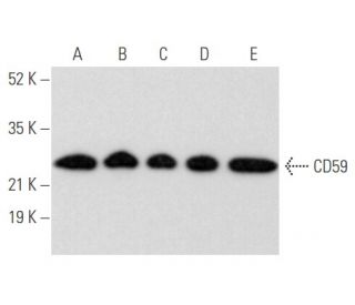 CD59 Antibody (YTH53.1) - Western Blotting - Image 355842 
