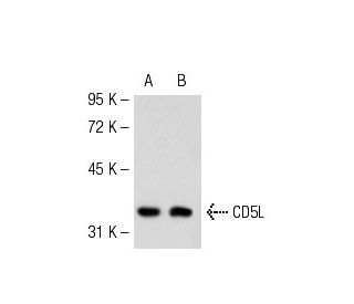 CD5L Antibody (18.2) - Western Blotting - Image 53787 