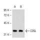 CD5L Antibody (18.2) - Western Blotting - Image 53787 