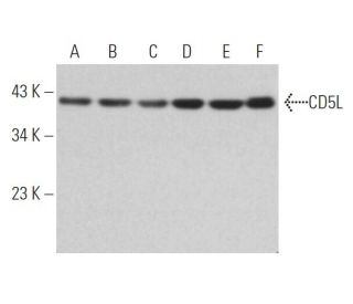 CD5L Antibody (D-11) - Western Blotting - Image 363953 