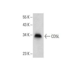 CD5L Antibody (F-5) - Western Blotting - Image 318030 