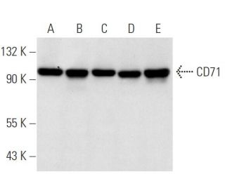 CD71/TFRC/Transferrin Receptor Antibody (2B6) - Western Blotting - Image 14332 
