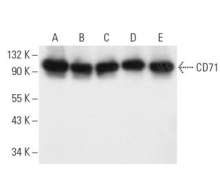 CD71/TFRC/Transferrin Receptor Antibody (3B8 2A1) - Western Blotting - Image 9570 