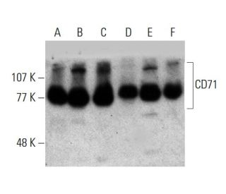CD71/TFRC/Transferrin Receptor Antibody (H68.4) - Western Blotting - Image 384032 