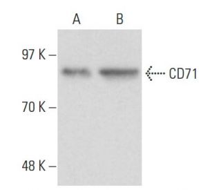 CD71/TFRC/Transferrin Receptor Antibody (T56/14) - Western Blotting - Image 17238