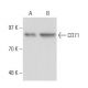 CD71/TFRC/Transferrin Receptor Antibody (T56/14) - Western Blotting - Image 17238