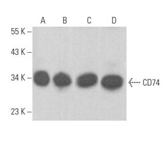 CD74 Antibody (2X31) - Western Blotting - Image 355183 
