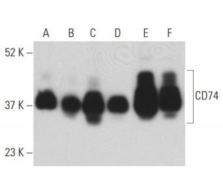 CD74 Antibody (LN-2) - Western Blotting - Image 398123 
