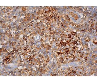 CD74 Antibody (OX4) - Immunohistochemistry - Image 368798
