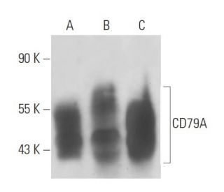 CD79A Antibody (HM57) - Western Blotting - Image 12849 