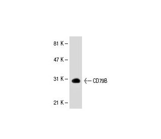 CD79B Antibody (HM79-11) - Western Blotting - Image 30577