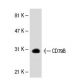 CD79B Antibody (HM79-11) - Western Blotting - Image 30577