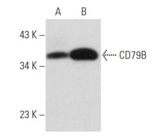 CD79B Antibody (SN8/3A2-2E7) - Western Blotting - Image 356895 