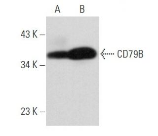 CD79B Antibody (SN8) - Western Blotting - Image 356894 