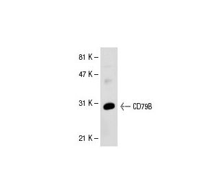 CD79B Antibody (ZL9-3) - Western Blotting - Image 30569 