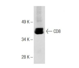 CD8 Antibody (32-M4) - Western Blotting - Image 284200 