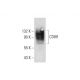 CD89 Antibody (MIP7c) - Western Blotting - Image 59911 