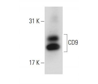 CD9 Antibody (ALB 6) - Western Blotting - Image 110018 