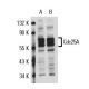 Cdc25A Antibody (3H2016) - Western Blotting - Image 17613 