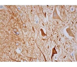 Cdc25A Antibody (DCS-122) - Immunohistochemistry - Image 293450 