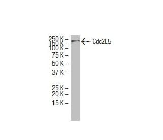 Cdc2L5 Antibody (ZZ08) - Western Blotting - Image 33485Each CRISPR/Cas9 Knockout (KO) Plasmid product consists of a pool of 3 plasmids designed to ensure identification and cleavage of a specific gene for maximum knockout efficiency. Each plasmid encodes a unique 20 nt sequence derived from the GeCKO (v2) library. 