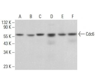 Cdc6 Antibody (0.N.189) - Western Blotting - Image 380839 