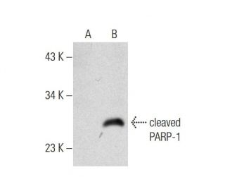 Cdc7/Cdk9 Inhibitor: sc-311303. Western blot analysis of PARP-1 expression in untreated (A) and Cdc7/Cdk9 Inhibitor treate 