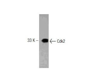 Cdk2 Antibody (55) - Western Blotting - Image 127495 