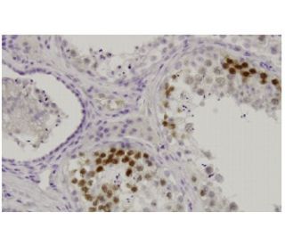 Cdk3 Antibody (4B6) - Immunohistochemistry - Image 35902