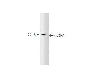 Cdk4 Antibody (97) - Western Blotting - Image 127496