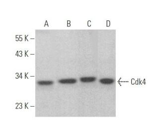 Cdk4 Antibody (DCS-156) - Western Blotting - Image 353338 