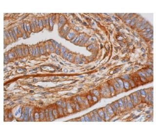 Cdk4 Antibody (F-8) - Immunohistochemistry - Image 352914 