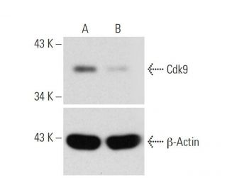 Cdk9 CRISPR/Cas9 KO Plasmid (h): sc-400242. Western blot analysis of... 