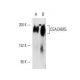 CEACAM5 Antibody (26/5/1) - Western Blotting - Image 14583 