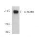 CEACAM5 Antibody (26/5/1) - Western Blotting - Image 371551