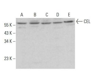 CEL Antibody (E-4) - Western Blotting - Image 383909
