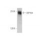 CEP164 Antibody (E-9) - Western Blotting - Image 346509 