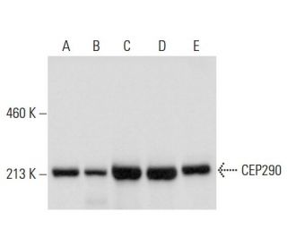 CEP290 Antibody (B-7) - Western Blotting - Image 314289 