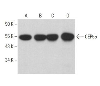CEP55 Antibody (B-8) - Western Blotting - Image 375400Each CRISPR/Cas9 Knockout (KO) Plasmid product consists of a pool of 3 plasmids designed to ensure identification and cleavage of a specific gene for maximum knockout efficiency. Each plasmid encodes a unique 20 nt sequence derived from the GeCKO (v2) library.